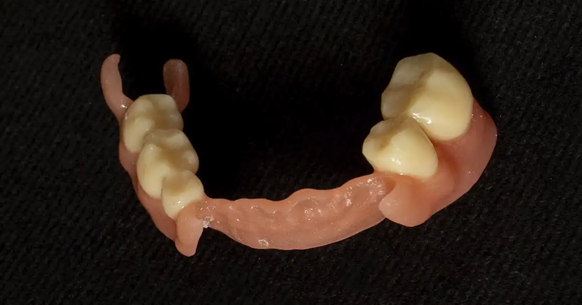 Prótesis flexible digital en Puerto Varas