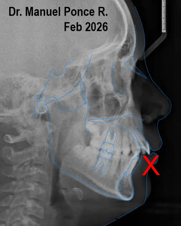 Radiografia lateral de confirmación