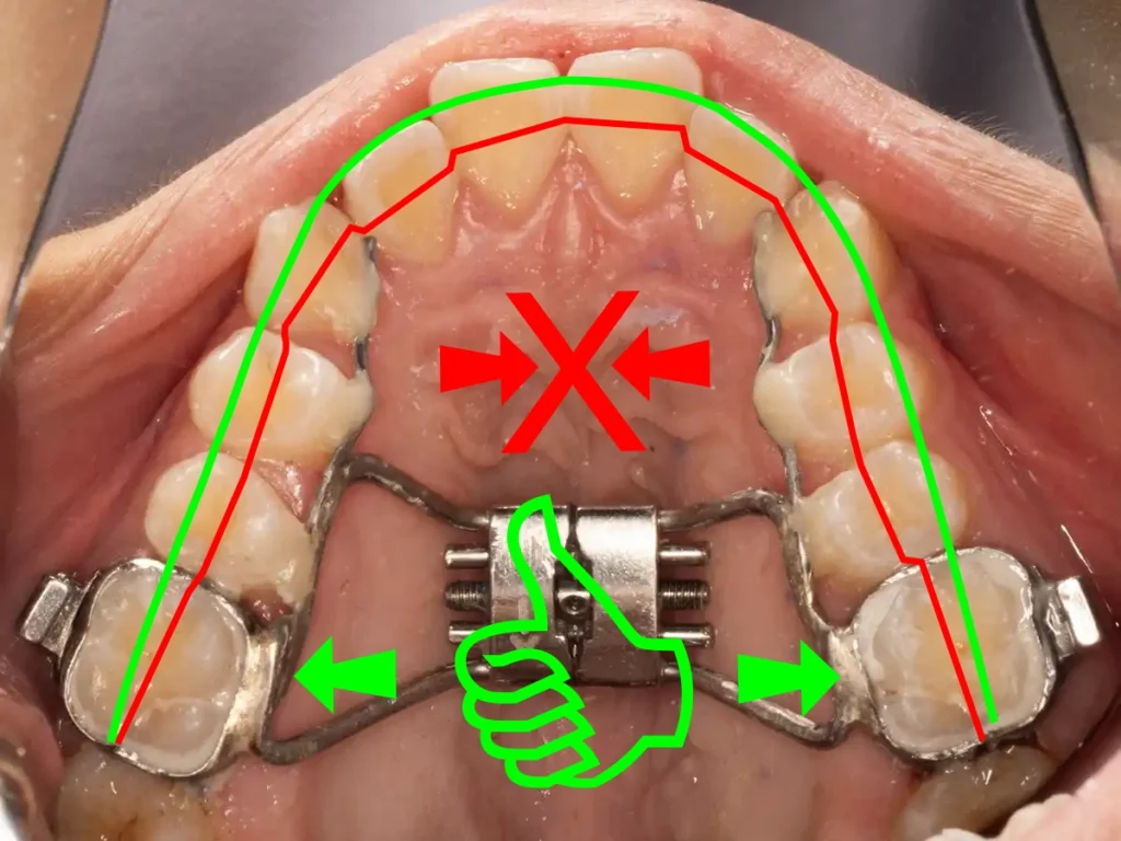 Disjuntor instalado en boca