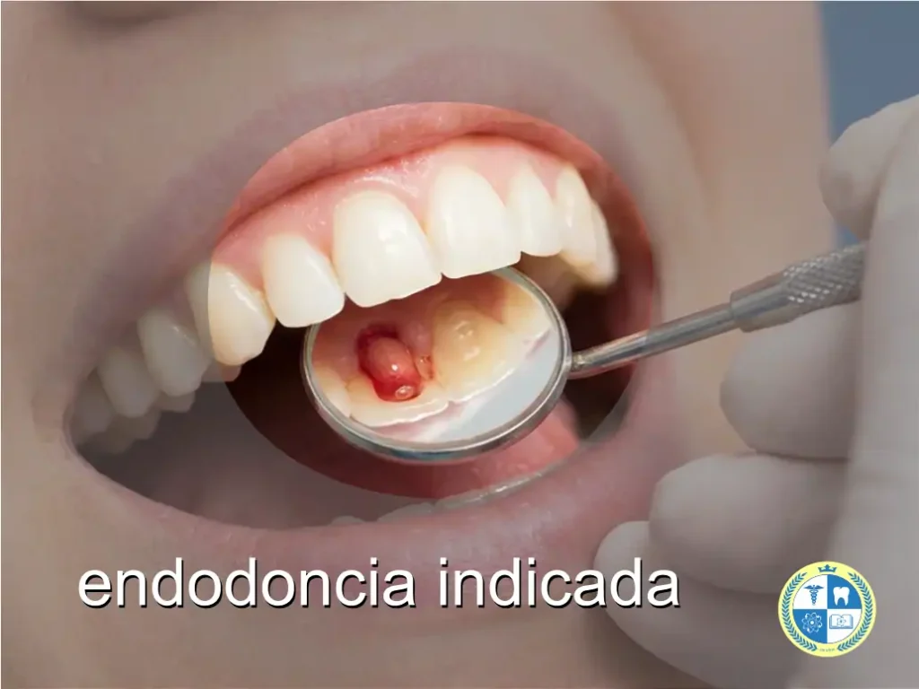 evaluacion endodoncia clinica manhood puerto varas